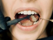 GENÇ DİŞ HEKİMLERİ GELECEK İÇİN DAHA GÜÇLÜ BİR SİSTEM İSTİYOR