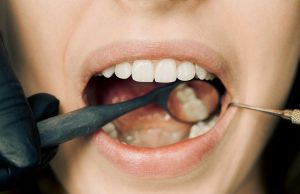 GENÇ DİŞ HEKİMLERİ GELECEK İÇİN DAHA GÜÇLÜ BİR SİSTEM İSTİYOR